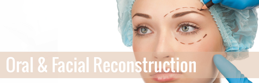 Oral and Facial Reconstruction
